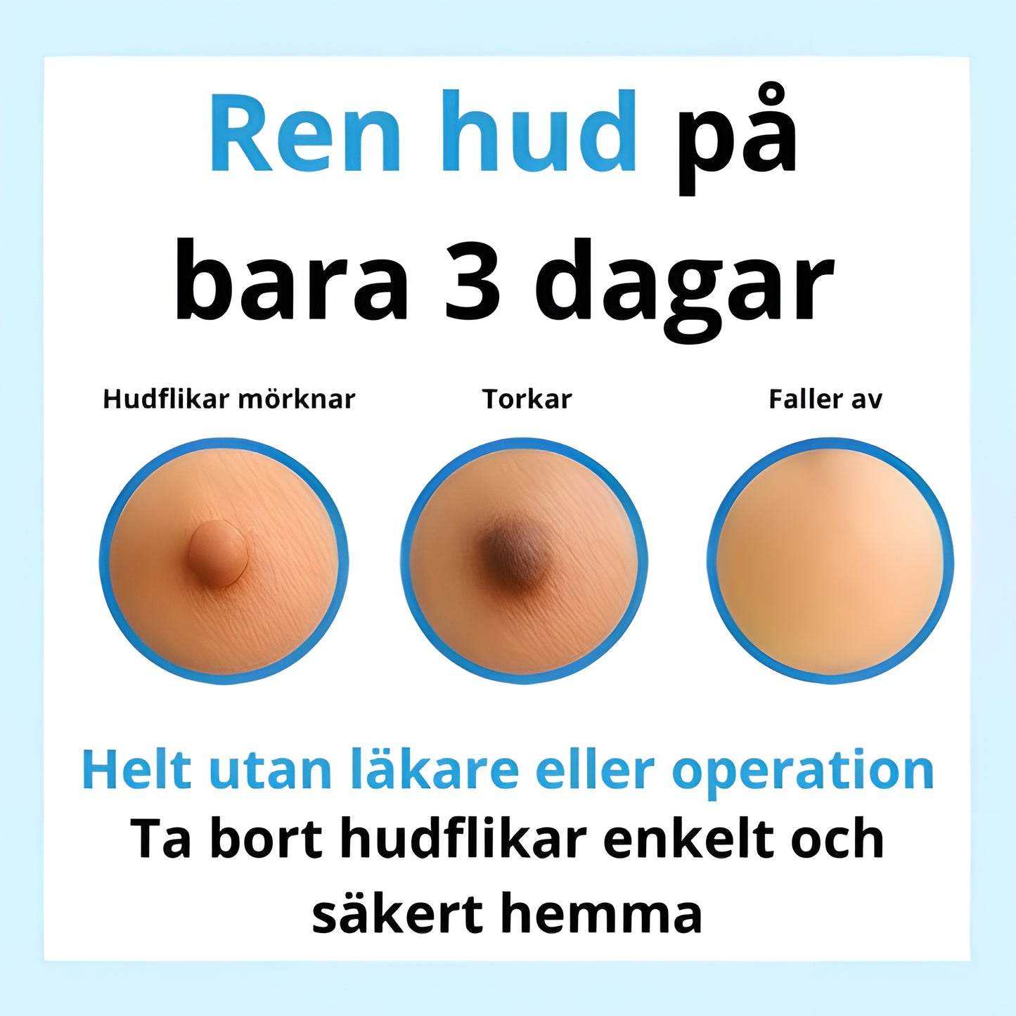 Lenhy™ - Hudfliksborttagaren